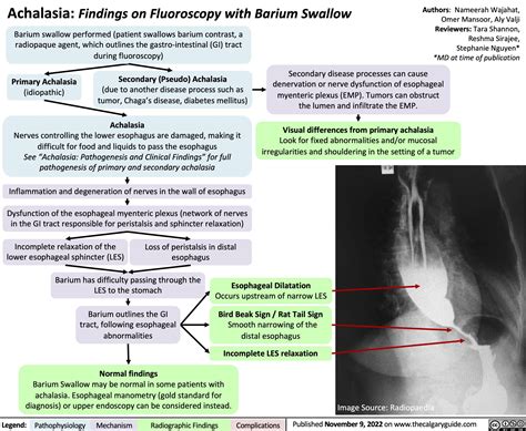 from publication Laparoscopic Heller Myotomy and Dor. . Esophageal manometry vs barium swallow